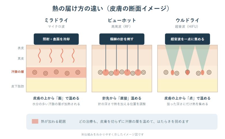 熱の届け方の違い