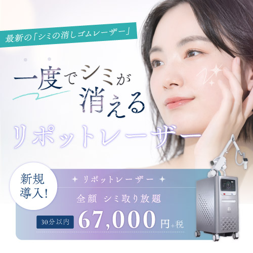リポットレーザー