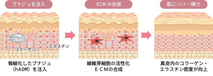 ブナジュ(BNAJU)のメカニズム図解