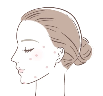 ジャルプロが効果的な施術部位