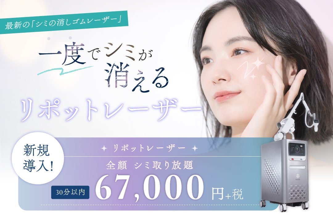 リポットレーザー