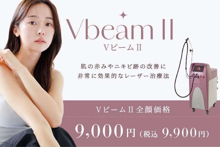 VビームⅡ