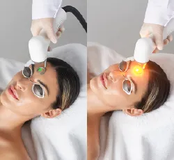 2波長のレーザー