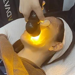 波長 589nm（黄色光）の照射画像