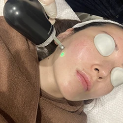 波長 1319nm（近赤外線）の照射画像