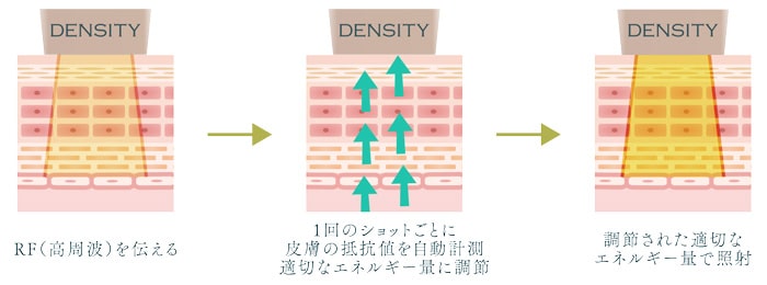 調節された適切なエネルギー量で照射