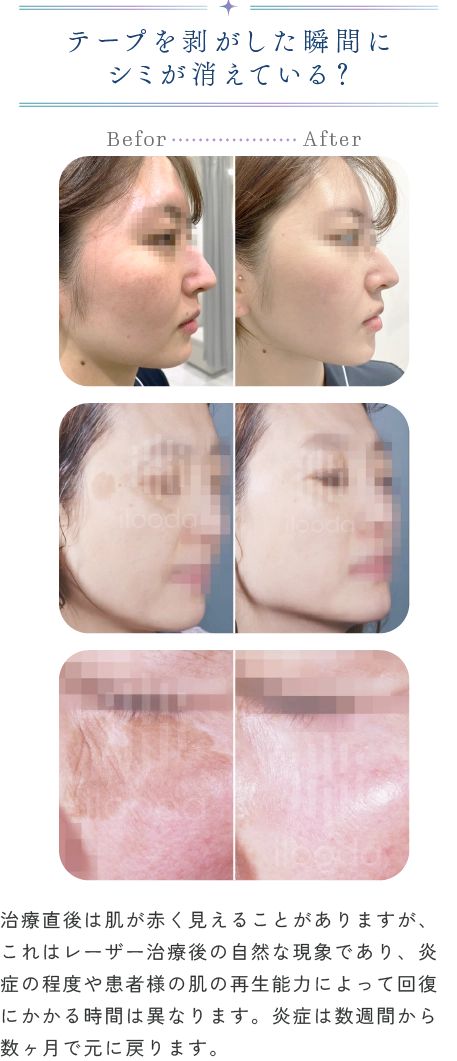 テープを剥がした瞬間にシミが消えている？