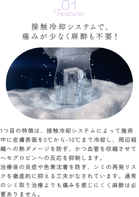 接触冷却システムで、痛みが少なく麻酔も不要！