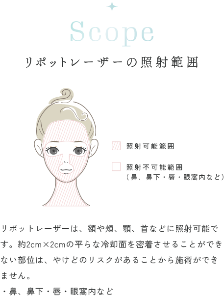 リポットレーザーの照射範囲