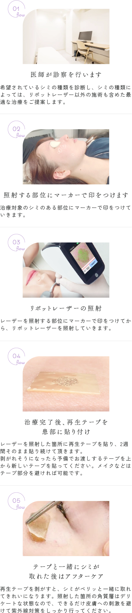 リポットレーザーの施術の流れ